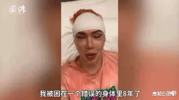 22歲加拿大男星花156萬變臉成BTS朴智旻，整形12次不幸過世