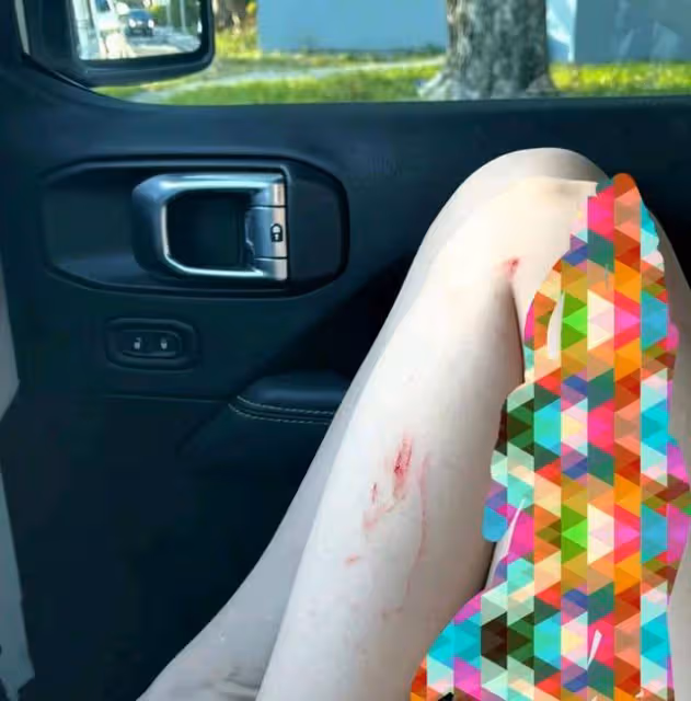 小彩旗曬照再受傷！生活照靈氣全無，放棄接班楊麗萍太可惜