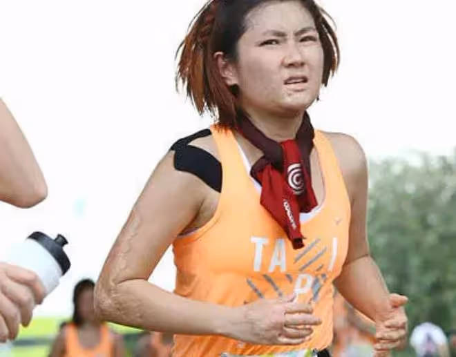 任家萱懷孕5月出席活動，情緒激動淚灑現場，燒傷13年疤痕仍明顯
