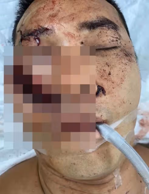 遇襲案判結！港男星揭被砍真相，行兇者混淆電影與現實而萌生殺意