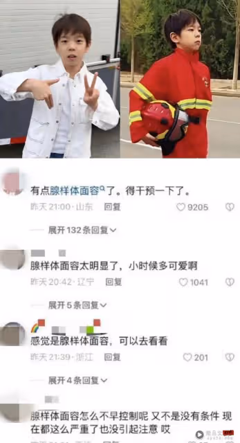 9歲嗯哼被指是腺樣體容貌！自卑承認自己不帥、不完美讓人心疼！