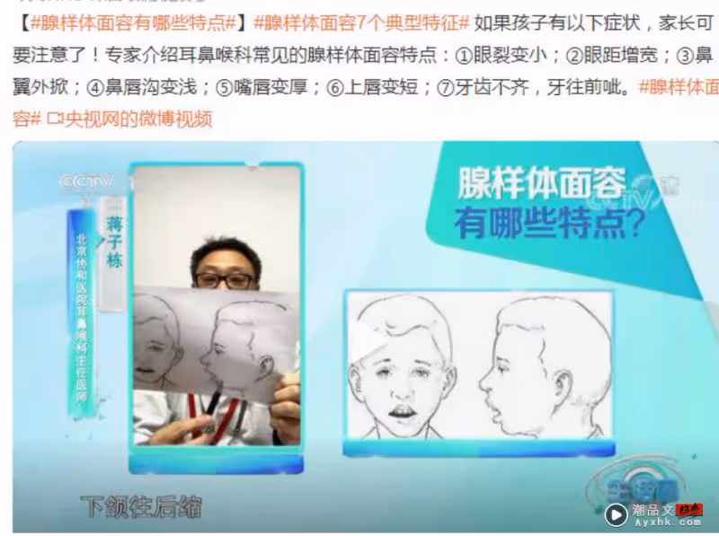 9歲嗯哼被指是腺樣體容貌！自卑承認自己不帥、不完美讓人心疼！
