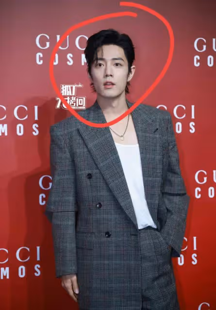 Gucci的紅毯生圖,暴露了肖戰的真實顏值,發腮、癟嘴處處是硬傷
