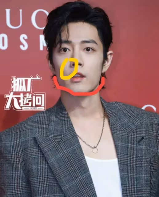 Gucci的紅毯生圖,暴露了肖戰的真實顏值,發腮、癟嘴處處是硬傷