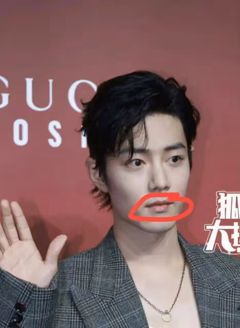 Gucci的紅毯生圖,暴露了肖戰的真實顏值,發腮、癟嘴處處是硬傷