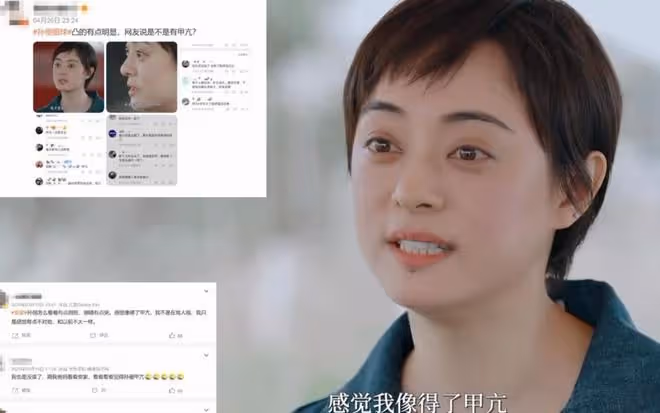 孫儷眼睛凸起遭網友質疑患甲亢,本人澄清真相,解釋熱衷養生內情