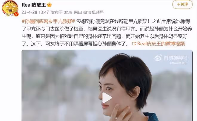 孫儷眼睛凸起遭網友質疑患甲亢,本人澄清真相,解釋熱衷養生內情