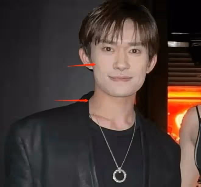 楊穎離婚後流言不斷,曬與谷愛凌合影只管自己美,谷愛凌發圖反擊