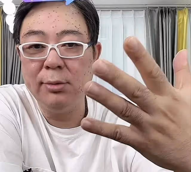 密恐慎點!高亞麟額頭長滿黑點惹擔憂,自曝生病許久疑似感染HPV