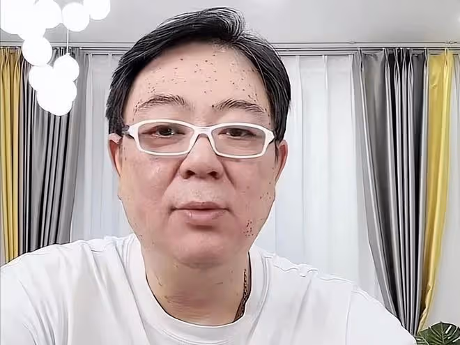 高亞麟:健康狀況引人擔憂,額頭上密密麻麻長滿小黑點,大小不一
