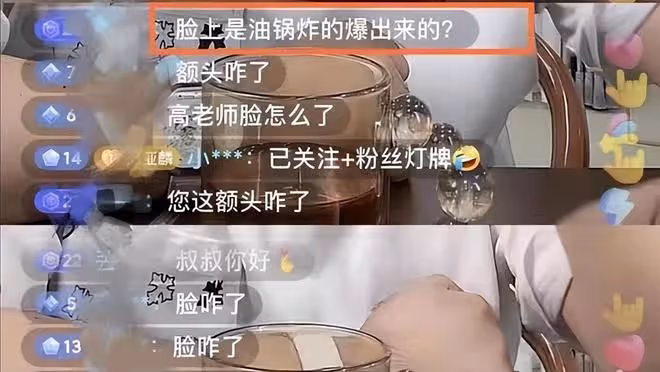 高亞麟:健康狀況引人擔憂,額頭上密密麻麻長滿小黑點,大小不一