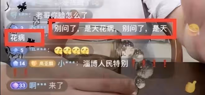 高亞麟:健康狀況引人擔憂,額頭上密密麻麻長滿小黑點,大小不一