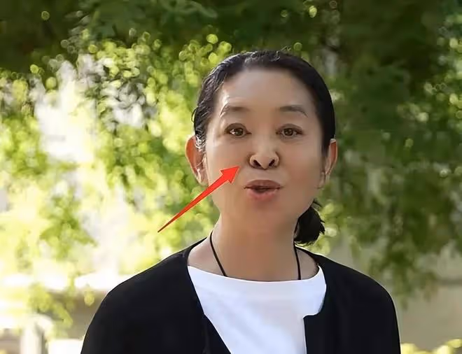 倪萍陶紅為奚美娟頒獎,兩位頒獎人臉僵不自然,與奚美娟對比鮮明