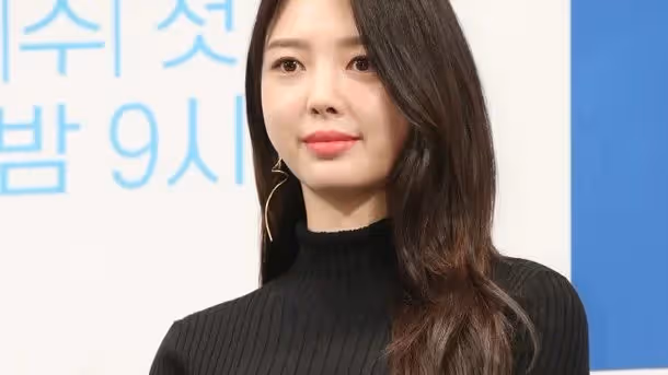 韓女星今年計劃休息，被質疑是做整容手術，她回應稱只是躺在家裡