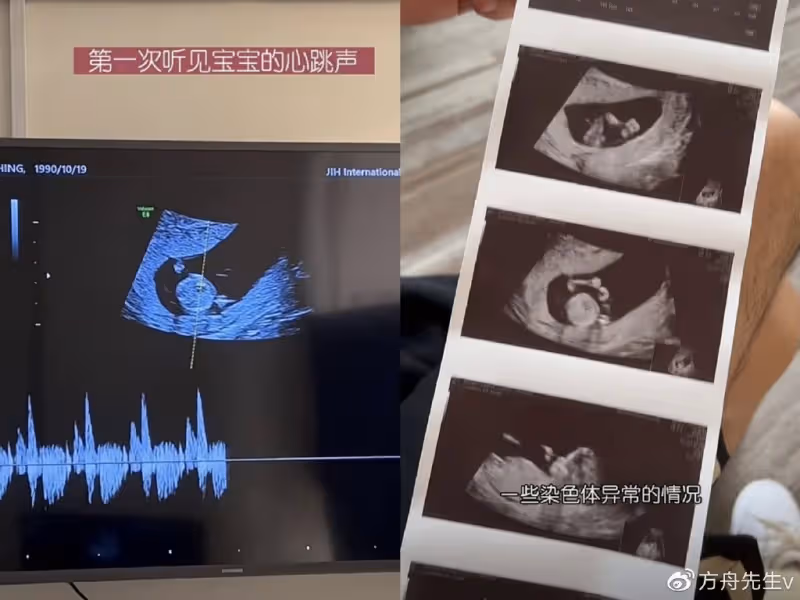 鄭愷前女友程曉玥分享生產全過程,在產房淡定分娩,摟高顏值老公慶祝