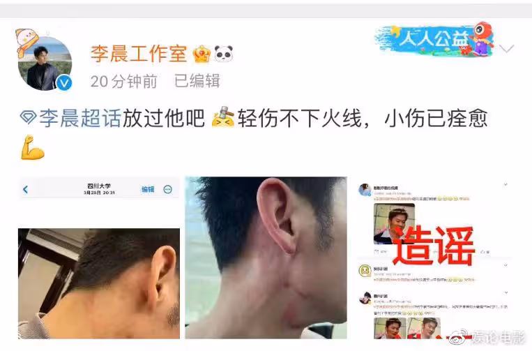 李晨方闢謠,是受傷不是唇印,已經不是第一次受傷了