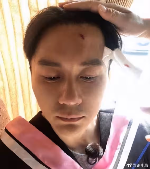 李晨方闢謠,是受傷不是唇印,已經不是第一次受傷了