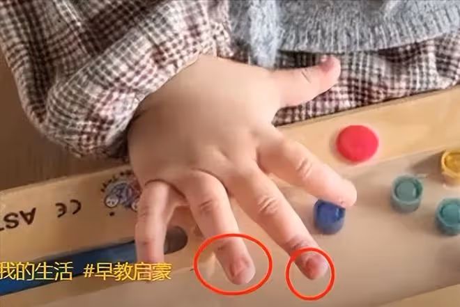李亞鵬落淚！二婚妻子患基因病，幼女恐遺傳，頻繁出差疑逃避現實