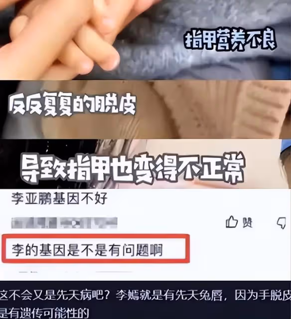 李亞鵬落淚！二婚妻子患基因病，幼女恐遺傳，頻繁出差疑逃避現實
