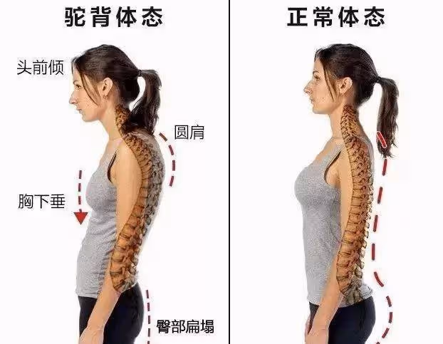 背薄顯瘦顯年輕，以減脂為基礎，鍛鍊背部肌肉，打造年輕體態