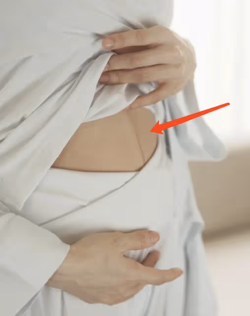 程曉玥自曝產後身材,因哺乳胸口冒青筋,妊娠線贅肉頸紋一樣不少