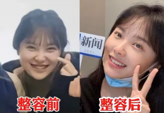 恭喜！「挖呀挖」黃老師成明星，登國家級電視台，素顏撞臉楊冪！