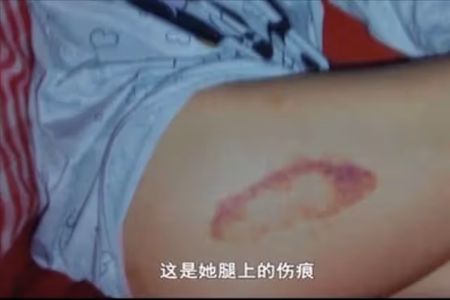 被毆打、侵犯、虐待,這些被家暴女人的遭遇,比恐怖片還毛骨悚然