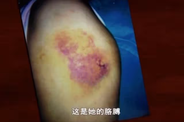 被毆打、侵犯、虐待,這些被家暴女人的遭遇,比恐怖片還毛骨悚然