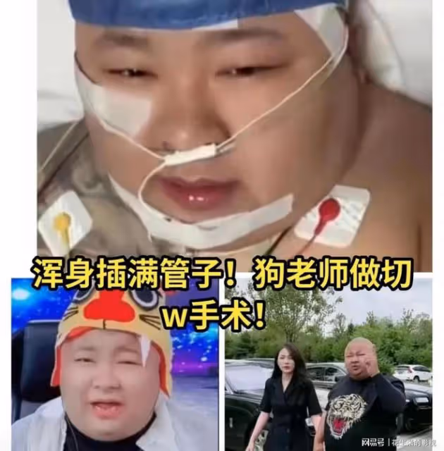 網紅胖猴一切結束，體重回升到600斤危及健康，教練表示救不了