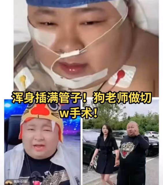 大網紅胖猴減重失敗,體重突然飆升到600斤,醫生感嘆表示救不了