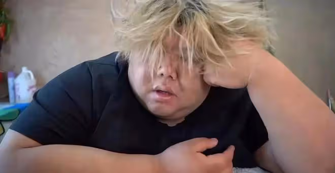 大網紅胖猴減重失敗,體重突然飆升到600斤,醫生感嘆表示救不了