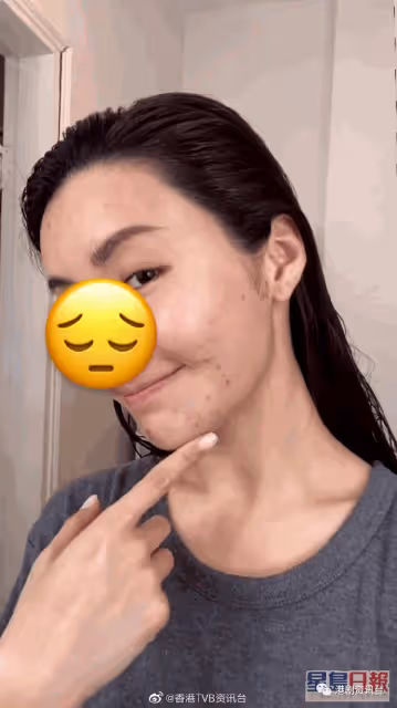 TVB小生女友突曬爛面相嚇窒網民!素顏跌曬Watt女神味全失