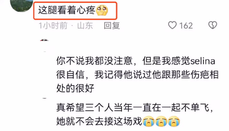 任家萱過母親節罕見穿短褲,雙腿燒傷疤痕暴露無遺,粉絲直呼心疼