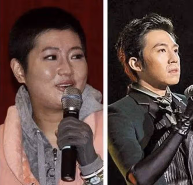 任家萱過母親節罕見穿短褲,雙腿燒傷疤痕暴露無遺,粉絲直呼心疼