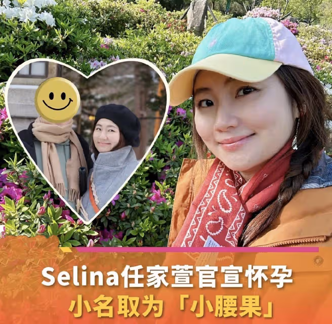 任家萱過母親節罕見穿短褲,雙腿燒傷疤痕暴露無遺,粉絲直呼心疼