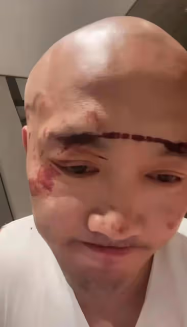 功夫明星武僧一龍被打頭破血流,警告不許用少林名義參加任何活動