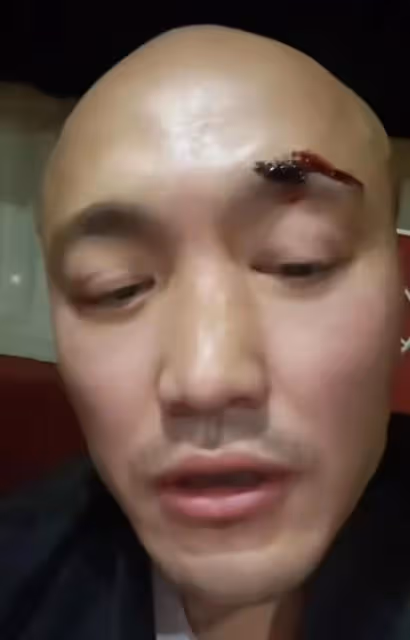功夫明星武僧一龍被打頭破血流,警告不許用少林名義參加任何活動