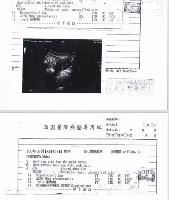 大S公開B超單承認2次胎死腹中,揭開自己遭罪的全部過程