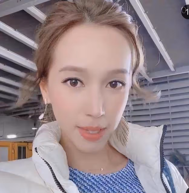 TVB混血兒小花聽網友意見,為變漂亮矯正牙齒,入行多年發展平平