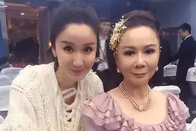 61歲整容上癮,後遺症凸顯,蔡明終於知道自己被醫美坑慘了
