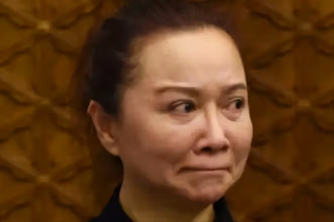 61歲整容上癮,後遺症凸顯,蔡明終於知道自己被醫美坑慘了