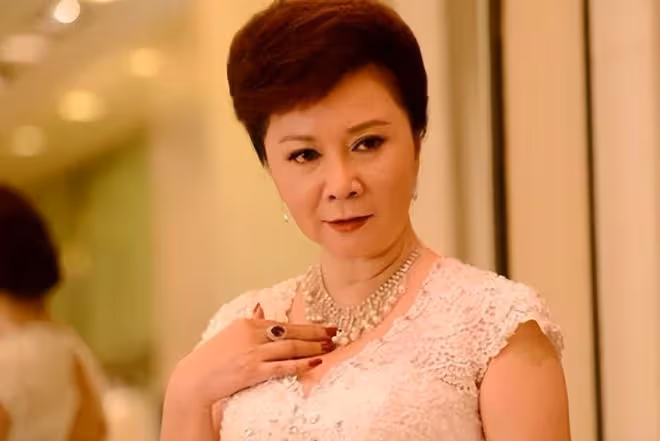 61歲整容上癮,後遺症凸顯,蔡明終於知道自己被醫美坑慘了