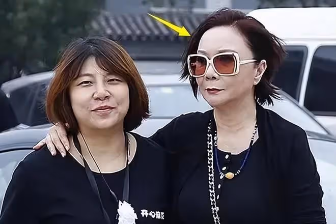 61歲整容上癮,後遺症凸顯,蔡明終於知道自己被醫美坑慘了