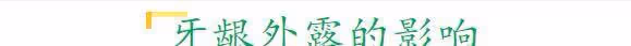 鼻孔外露不要緊，「牙齦外露」才拉垮，一笑就土氣，高圓圓都遭殃