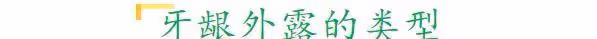 鼻孔外露不要緊,「牙齦外露」才拉垮,一笑就土氣,高圓圓都遭殃