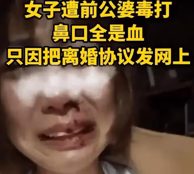 女子網上曬離婚協議被公婆暴打,知情人曝出內幕,挨打一點都不冤