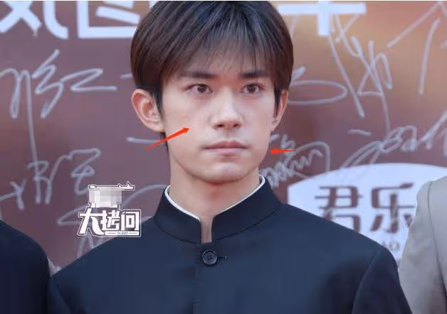 華表獎紅毯名場面,王一博西褲開線,記者稱陳都靈比白鹿好看