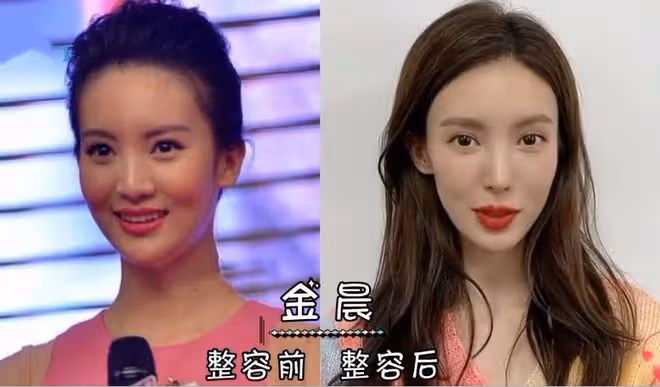 表面是精緻美人,實則是饅頭臉、歪鼻子,這些女星的臉太假了