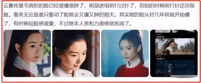 表面是精緻美人,實則是饅頭臉、歪鼻子,這些女星的臉太假了