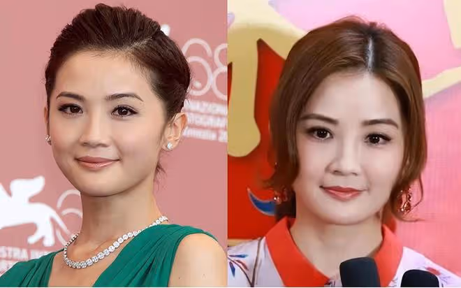 表面是精緻美人,實則是饅頭臉、歪鼻子,這些女星的臉太假了